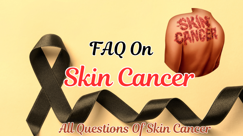 faq on skin cancer