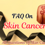 faq on skin cancer