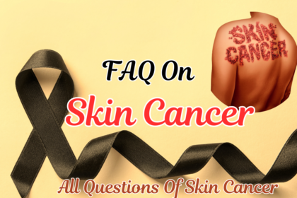 faq on skin cancer