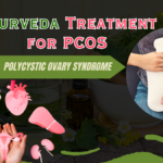 Ayurveda Treatment for PCOS