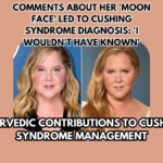 Amy Schumer was diagnosed with Cushing syndrome