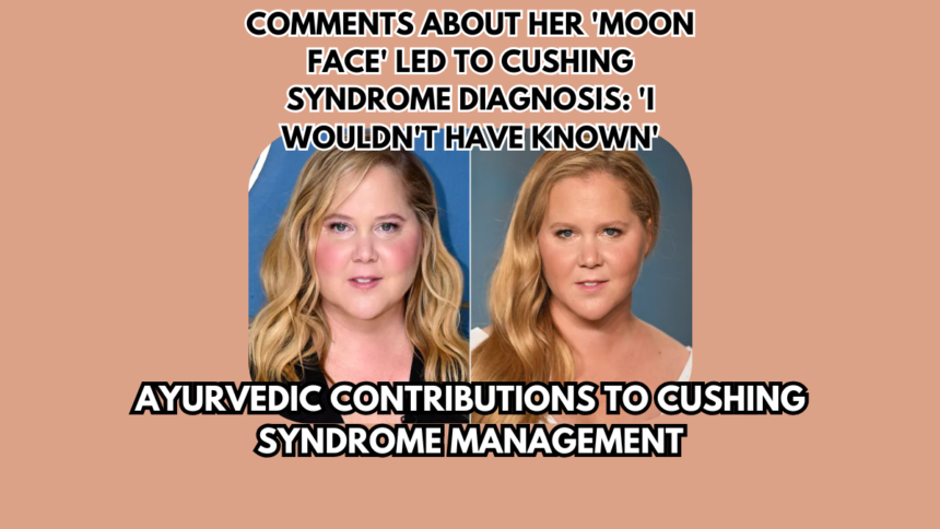 Amy Schumer was diagnosed with Cushing syndrome