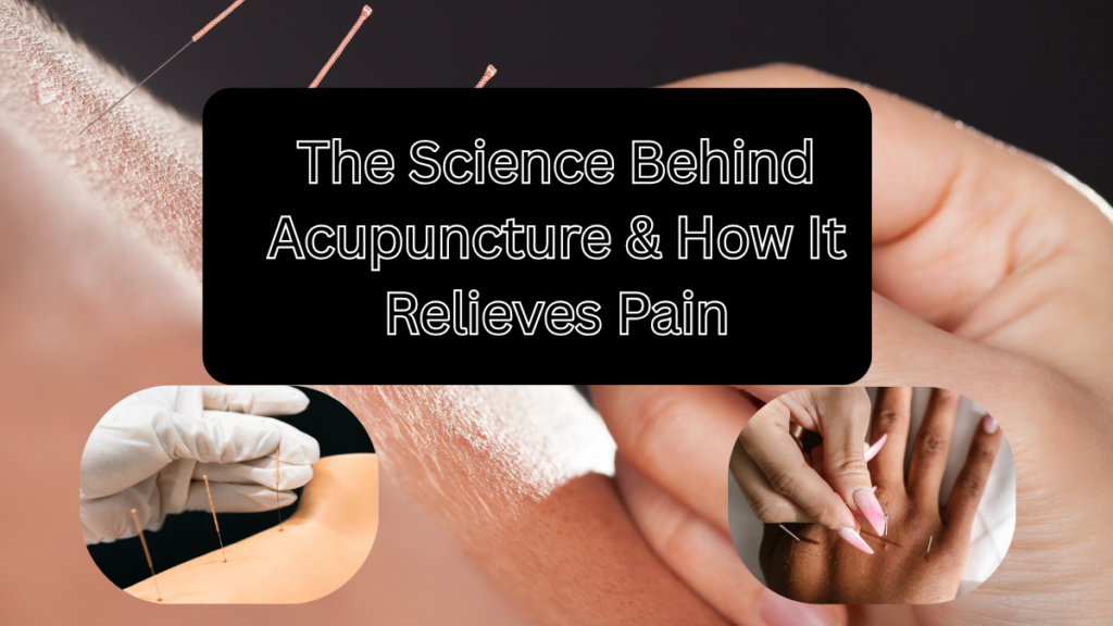 The Science Behind Acupuncture & How It Relieves Pain Science Behind Acupuncture