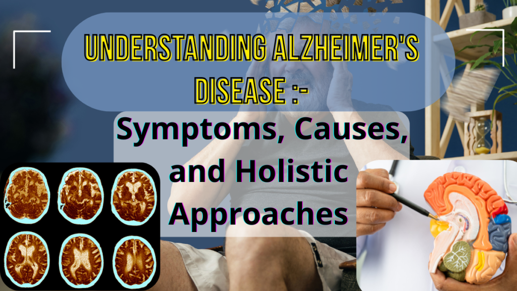 Alzheimer Disease 
