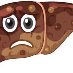 Liver Flukes & Ayurvedic Management: A Holistic Path to Liver Health