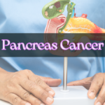 Pancreas Cancer