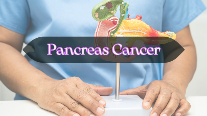 Pancreas Cancer