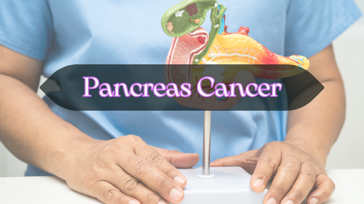 Pancreas Cancer