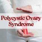 Polycystic Ovary Syndrome