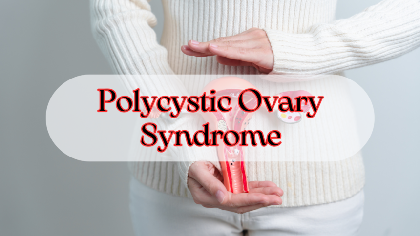 Polycystic Ovary Syndrome
