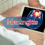 Meningitis