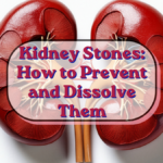 Kidney Stones