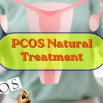 PCOS Natural Treatment