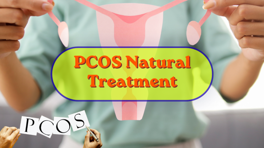 PCOS Natural Treatment