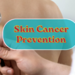 Skin Cancer Prevention